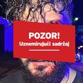 FOTO Novinara iz BiH brutalno pretukao bokserom: 'Došao mi je s leđa. Čekao ga je sivi auto'