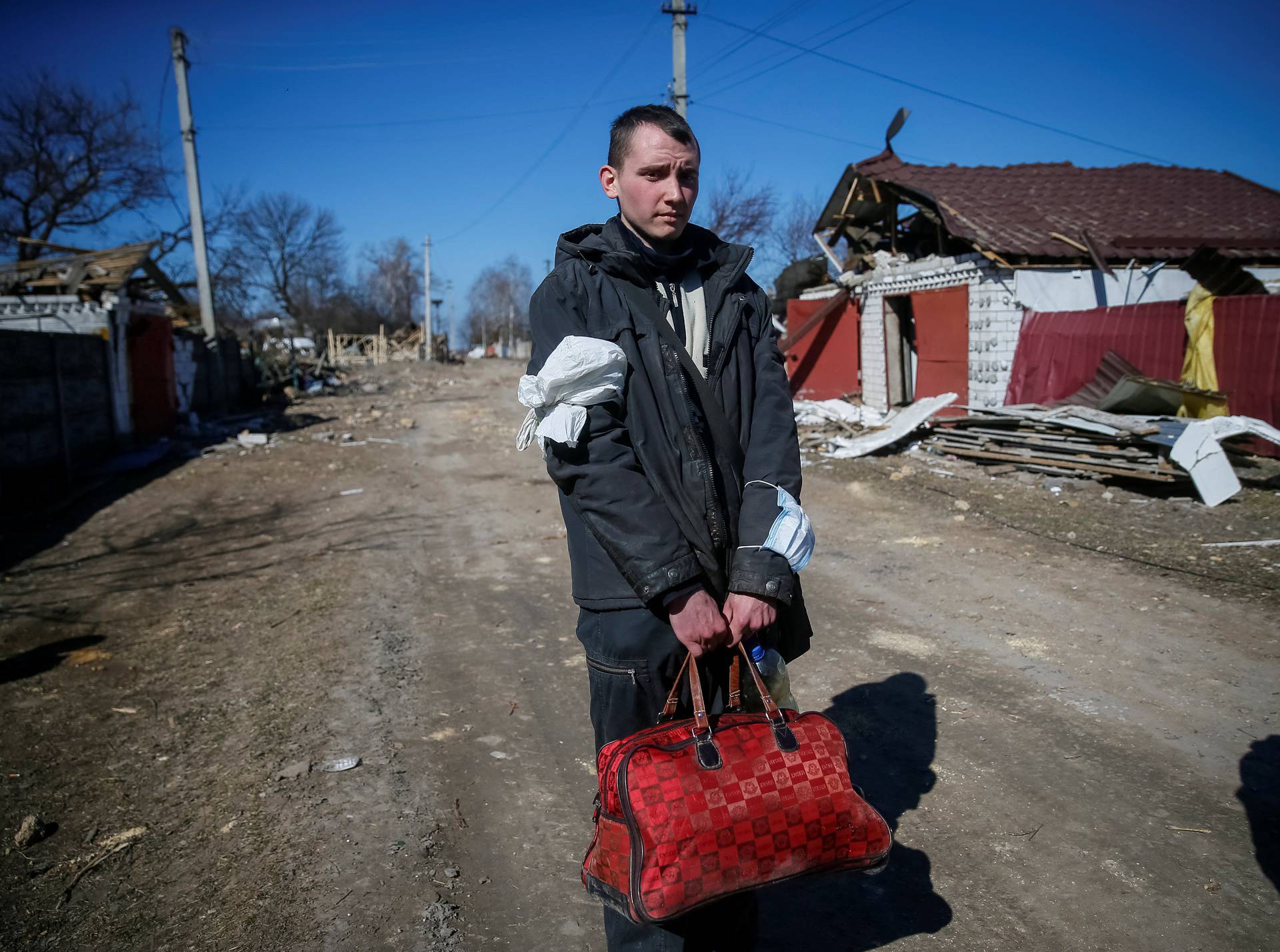A man is seen in a Ukrainian-controlled village after he crossed the front line from a Russian-occupied village in northern Kiev region