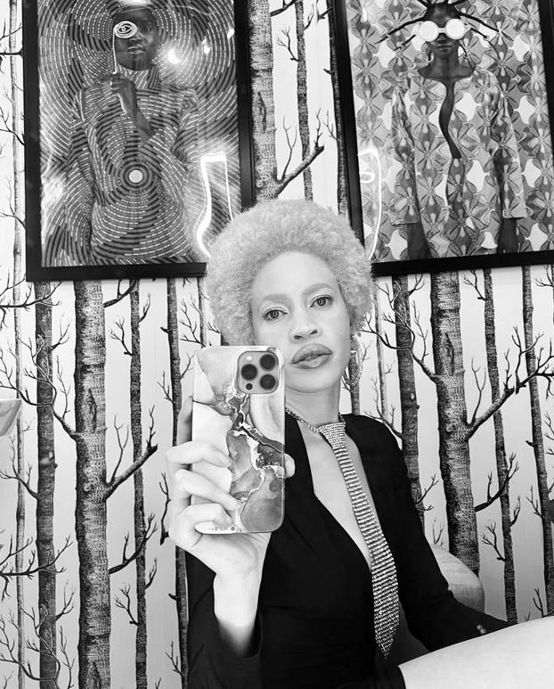 FOTO Afrikanka s albinizmom osvaja modnu industriju: 'Često privlačim znatiželjne poglede'