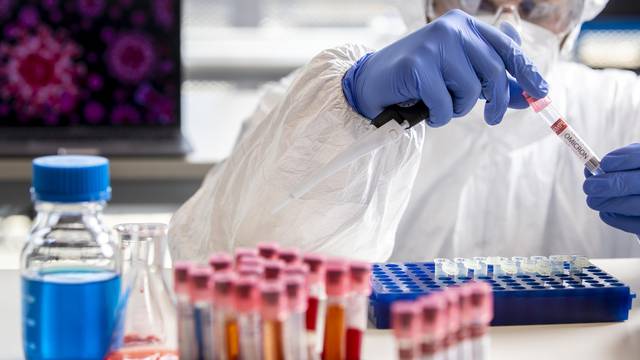 U Varaždinskoj županiji 49 novozaraženih koronavirusom, jedna osoba umrla