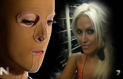 Pod maskom bila dvije godine: Australka (28) otkrila novo lice