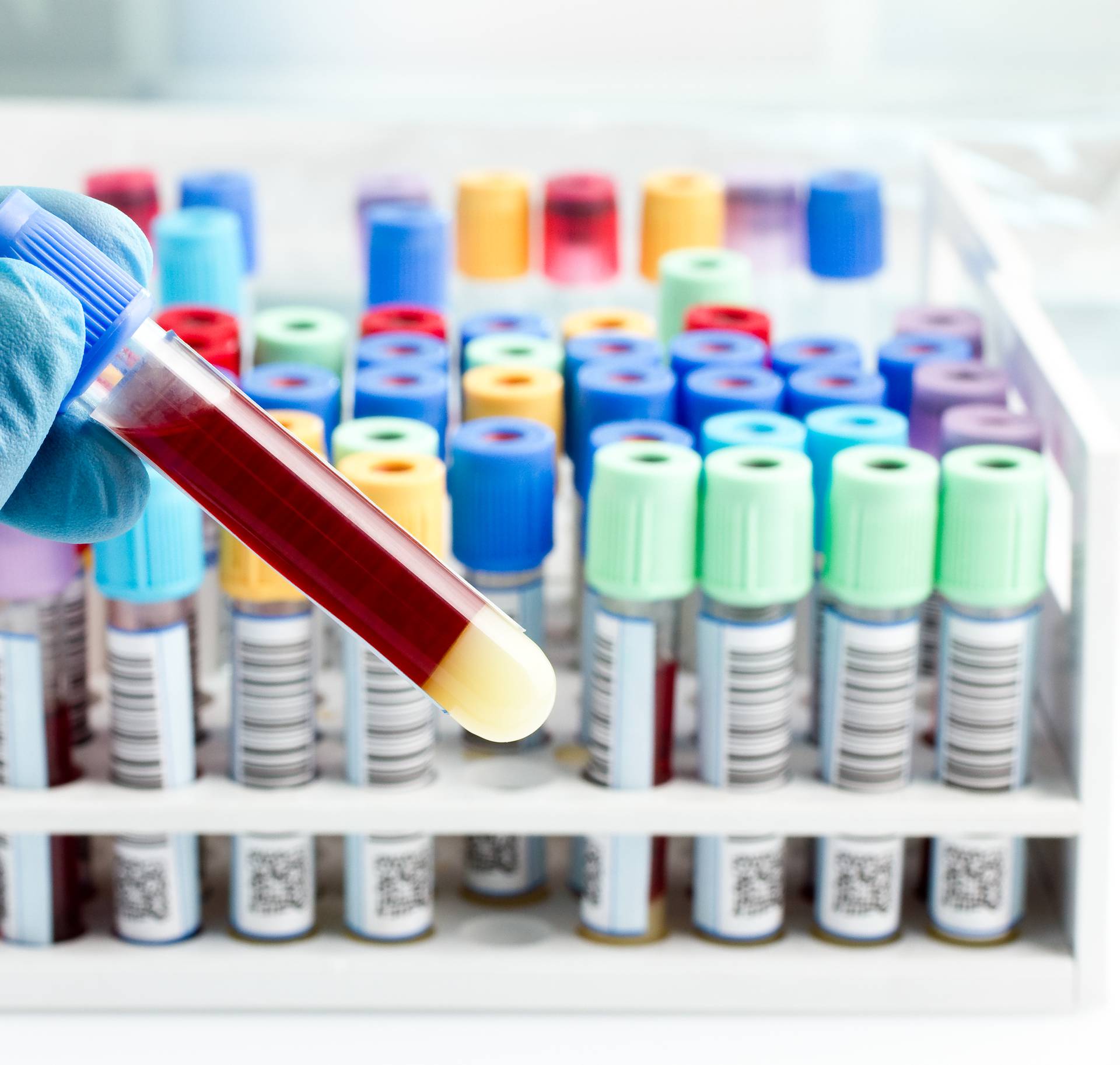 Australski istraživači izumili 20-minutni test krvi na koronavirus