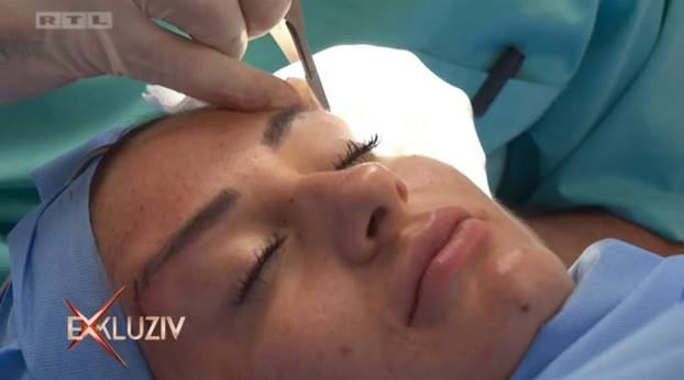 Na kirurga koji je unakazio žene žalila se i Kristina Mandarina. Evo što je njoj operirao...