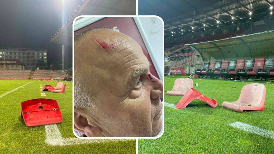 Huligani u Zenici sjedalicama pogodili liječnika i kamermana