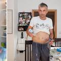 Zagrepčanin Hrvoje (45) već deset godina živi bez imuniteta