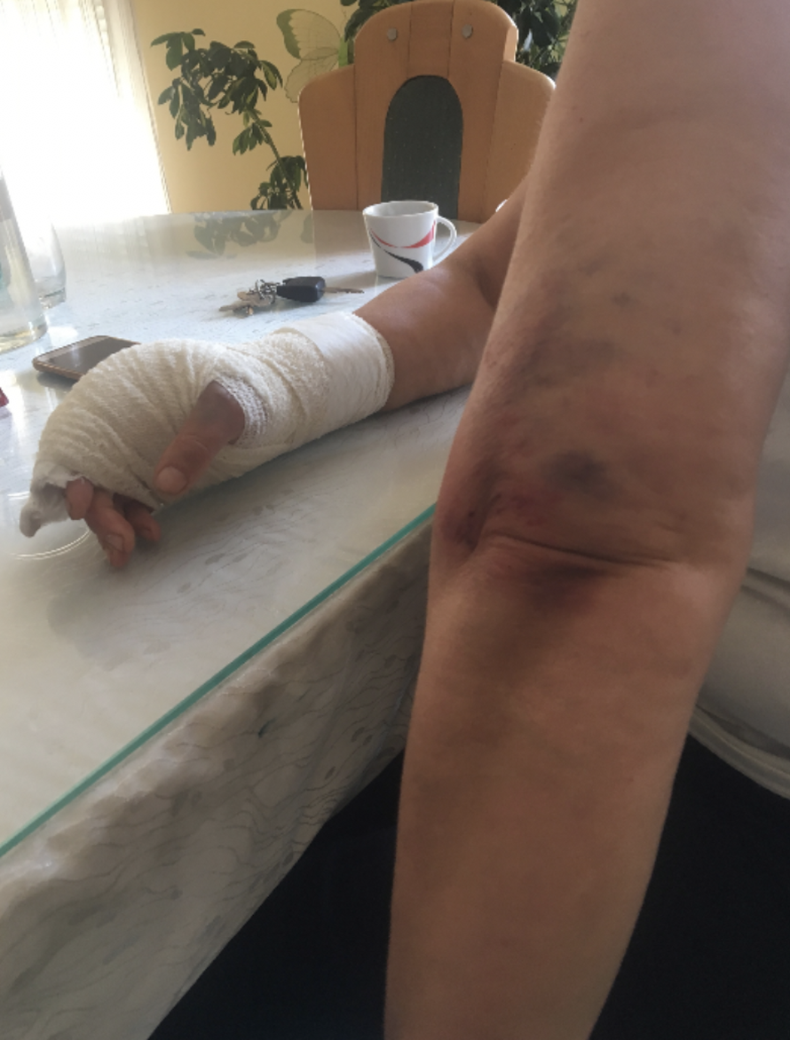 Manijak letvom udarao  trudnu ženu: Strah nas je, u šoku smo