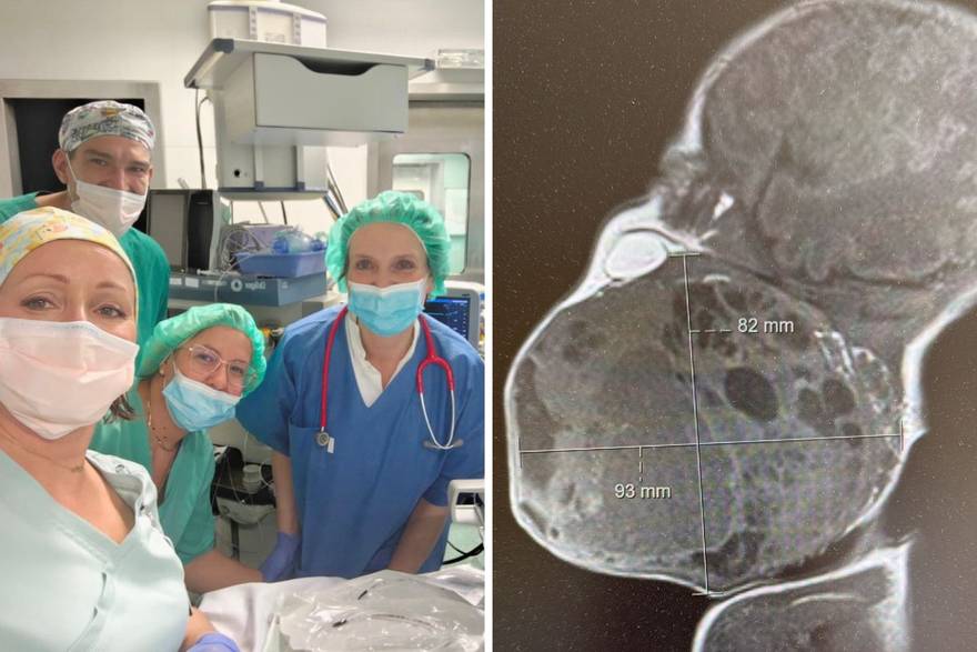 Konferencija za medije povodom uspješne operacije