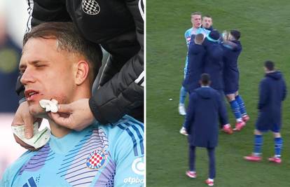 Galešić brutalno kopačkom u lice Lučića! Hajdukov golman nakon završetka dobio šamar