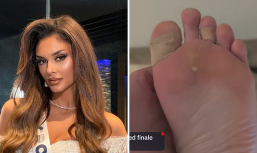 Misica Laura objavila je fotke stopala: 'Teže nego na Hitnoj'