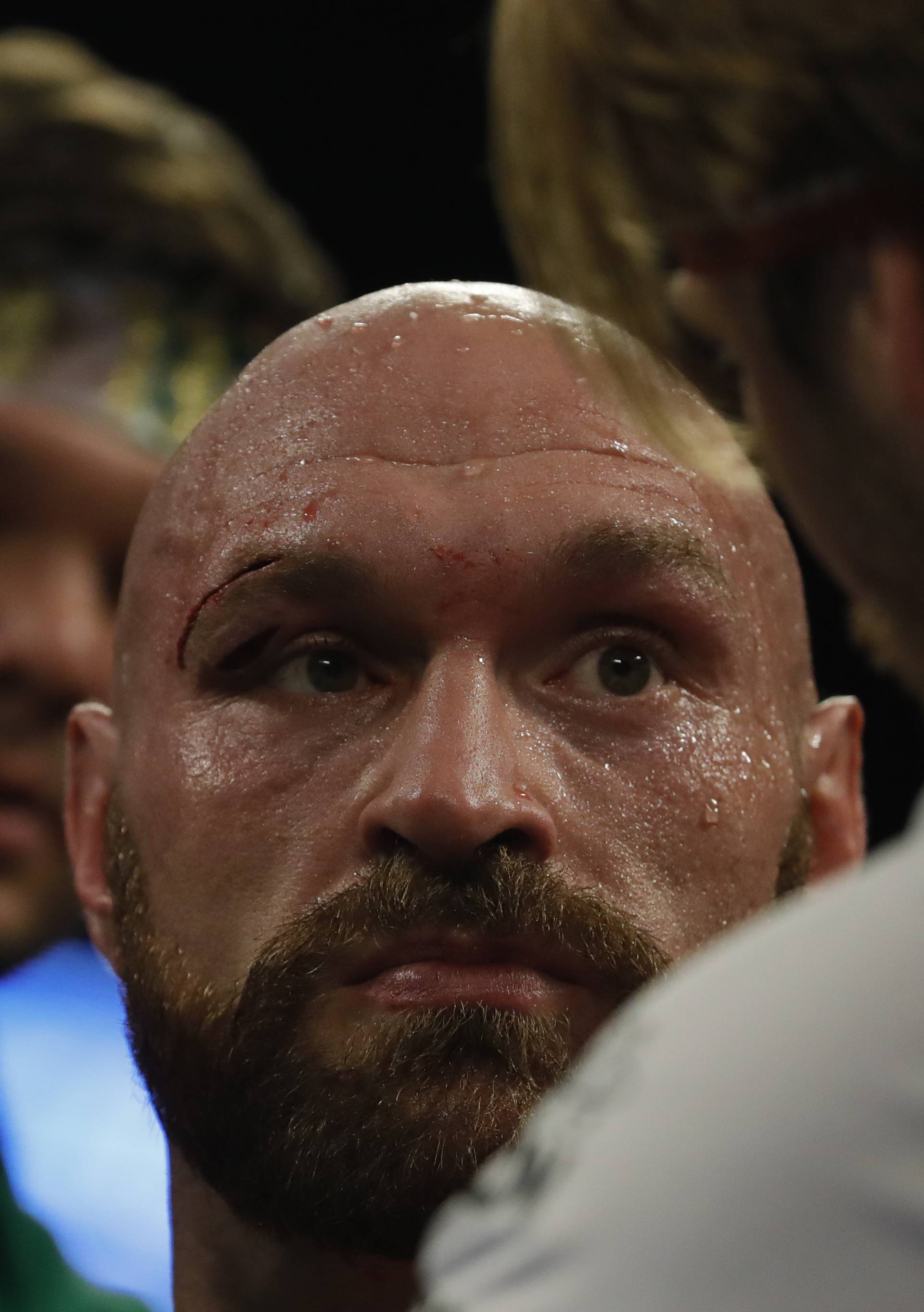 Tyson Fury v Otto Wallin