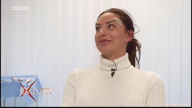 Na kirurga koji je unakazio žene žalila se i Kristina Mandarina. Evo što je njoj operirao...