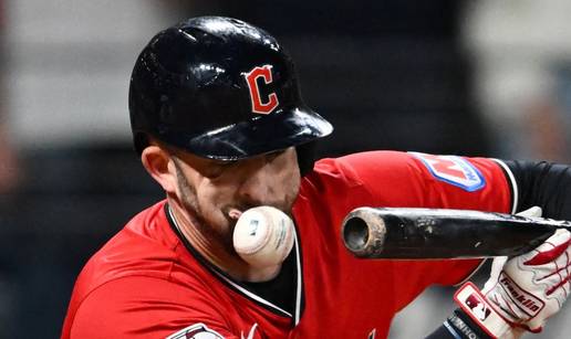 Ovako izgleda lice čovjeka kad ga pogodi loptica sa 160 km/h