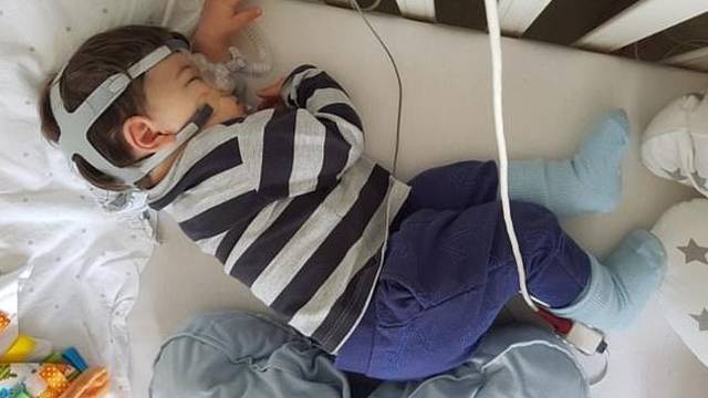 Rijedak poremećaj: Dječak (1) prestaje disati kad utone u san