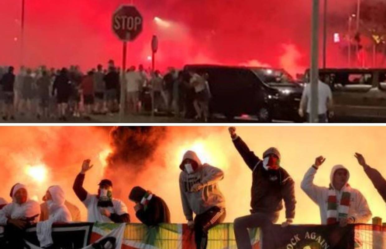 Veteran - huligan Legije leži u KBC Rebro, ima slomljenu nogu i 'mali milijun' starih ozljeda