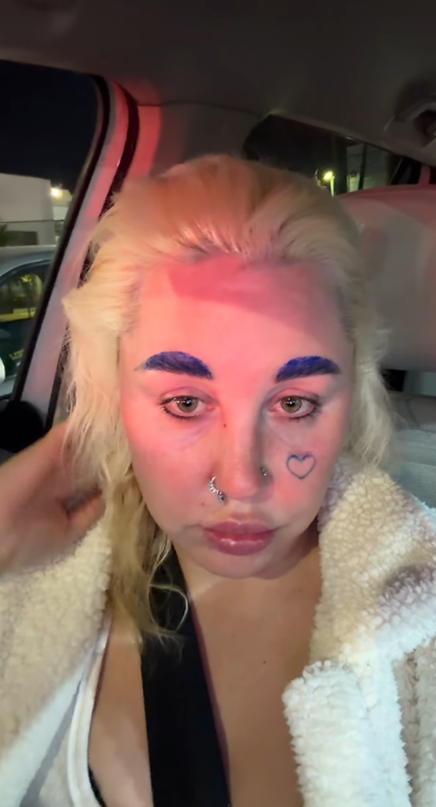 Posrnula dječja zvijezda otkrila: 'Smršavila sam 13 kilograma'