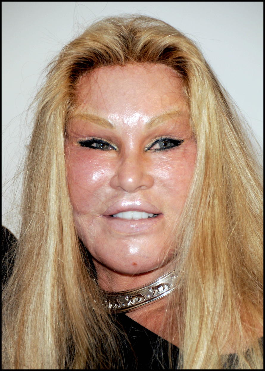 Preminula 'žena mačka' Jocelyn Wildenstein (84). Milijarde je trošila na bezbrojne operacije