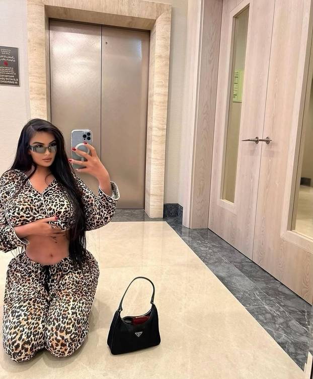 FOTO Brazilka Jennifer: Bila sam ovisna o estetskim zahvatima! Potrošila sam preko 800.000 $