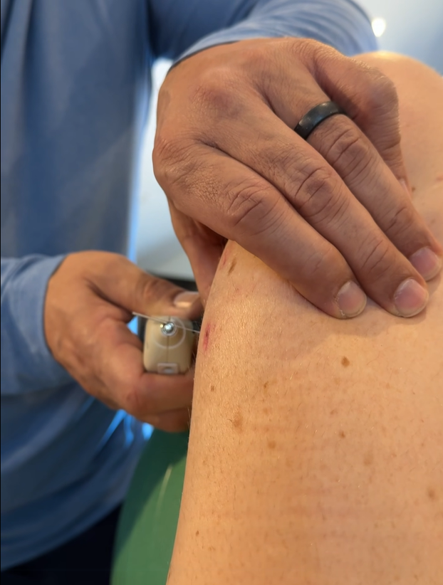 FOTO Je li moguće? Pogledajte što radi Lindsey Vonn nekoliko tjedana od stravične nesreće