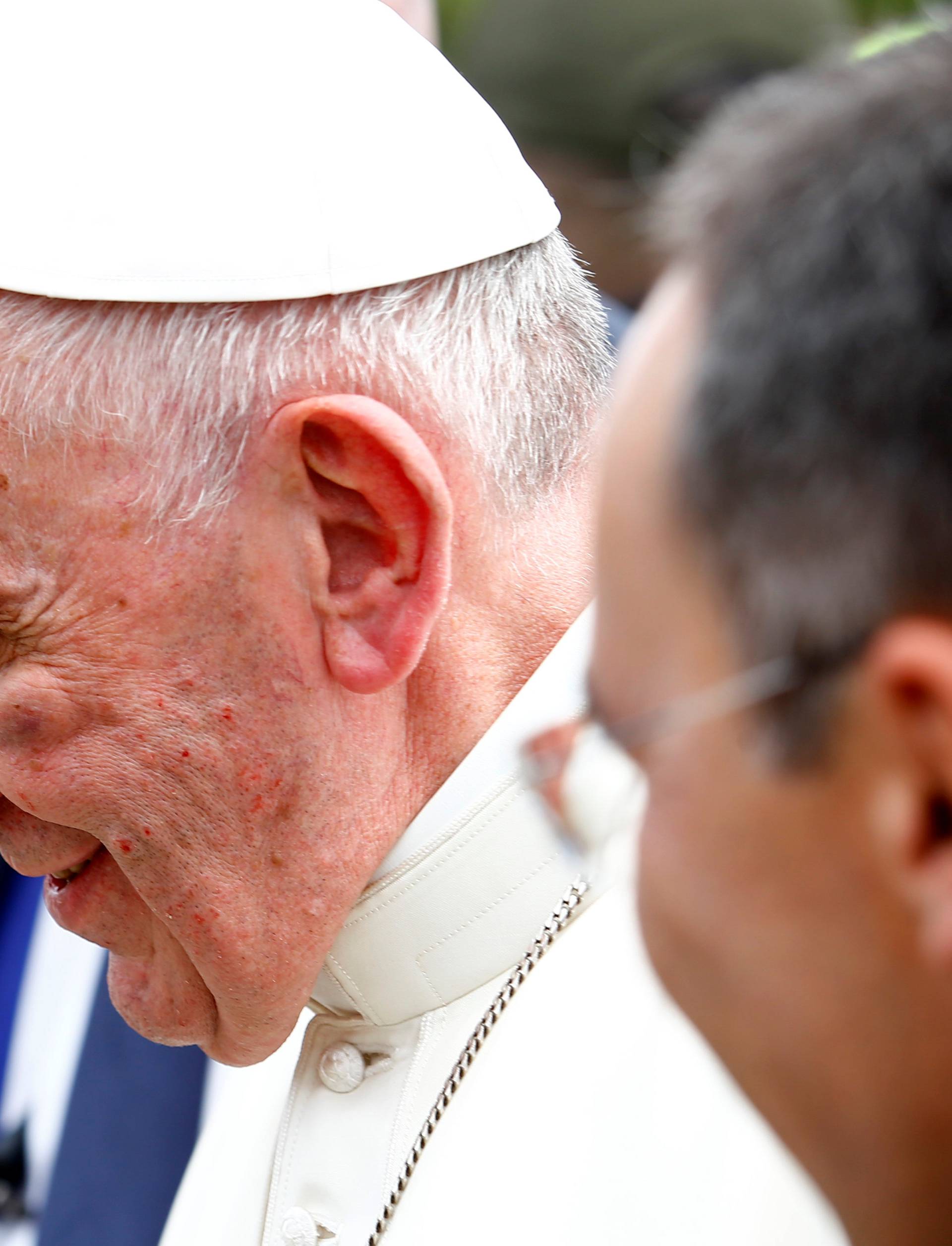 Pope Francis shows a bruise around his left eye and eyebrow caused by an accidental hit against the popemobile's window glass while visiting the old sector of Cartagena