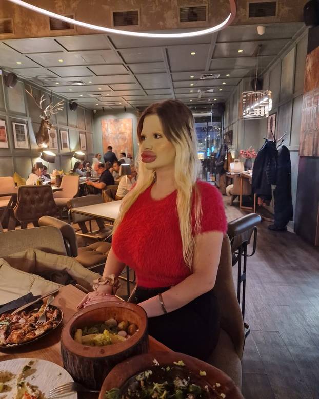 FOTO Žena s najvećim usnama na svijetu otkrila kako je nekoć izgledala: Šok! Bila si prekrasna