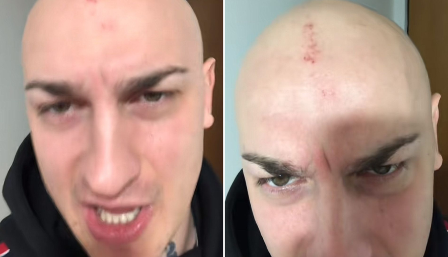 Srpski glazbenik lupao fanove tenisicom po glavi u Opatiji, sad i on ozlijeđen: 'Što ja radim?!'