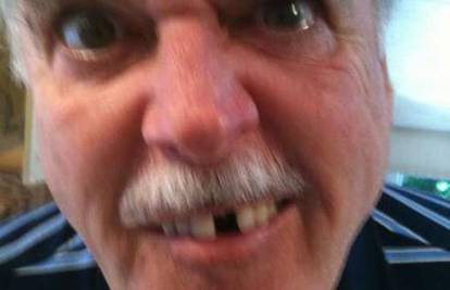J. Cleese objavio na Fejsu: Pogledajte, ispao mi je zub