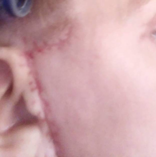 Na istog se estetskog kirurga žalila i Kristina Mandarina. Pogledajte kako je izgledala