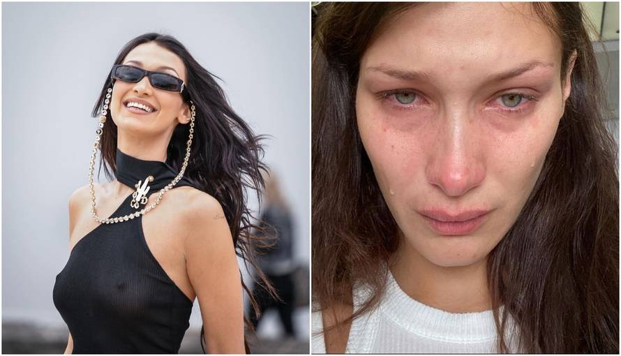 Bella Hadid priznala: 'Stalno sam se vraćala muškarcima i ženama koji su me zlostavljali'