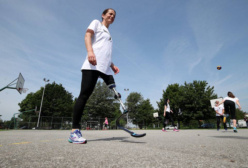 Sportske proteze za djecu s amputacijom donjih udova