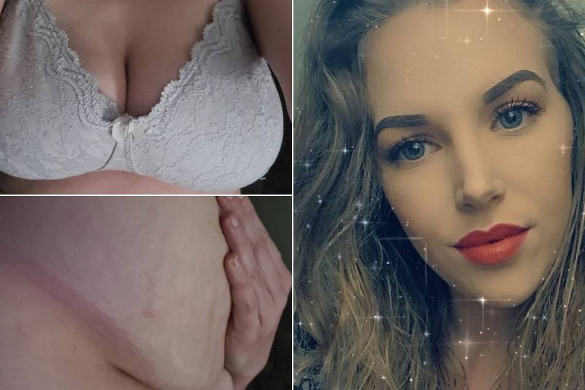'Moje grudi mi uništavaju život, nosim košarice veličine H i očajnički mi treba smanjenje'