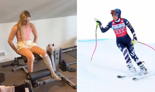 FOTO Od katastrofalne ozljede do reprezentacije u 8 mjeseci: Evo kako se Vonn oporavljala