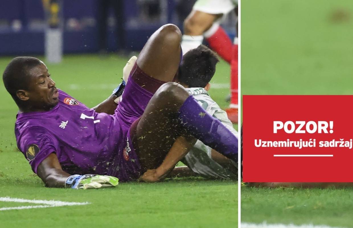 Stravična ozljeda meksičkog nogometaša: Sudario se s golmanom, nastradala glava