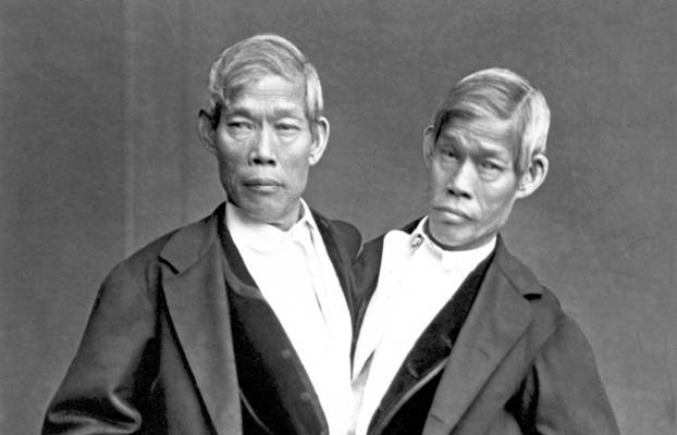 Thailand / USA: Chang and Eng Bunker, the original conjoined 'Siamese Twins', in their later years, North Carolina, 1865