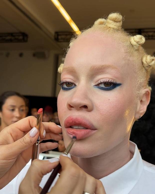 FOTO Afrikanka s albinizmom osvaja modnu industriju: 'Često privlačim znatiželjne poglede'