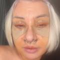 Danijela Dvornik otišla na 'face lift': Evo koliko taj zahvat košta