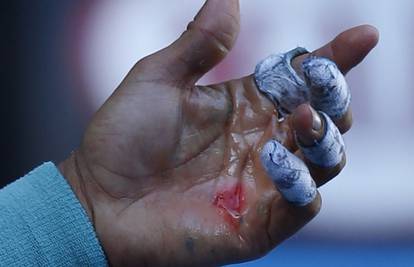 Nadal je krvario za polufinale: Jedva sam držao reket u ruci