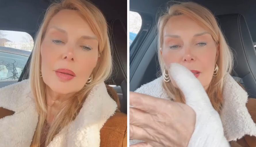 Čeljuska za 24sata: Slomila sam prst na ruci sekundom nepažnje