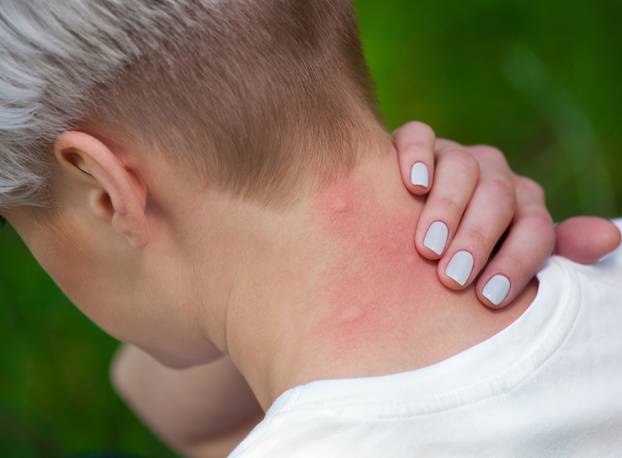 20 primjena sode bikarbone