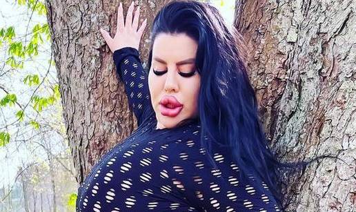 FOTO Stražnjica mi teži 45 kila, no već imam u planu sljedeću operaciju, želim imati najveću!