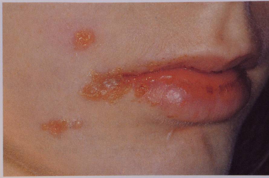 Zadar: Gordana Bubi?i?-Bajek, specijalistica dermatovenerologije