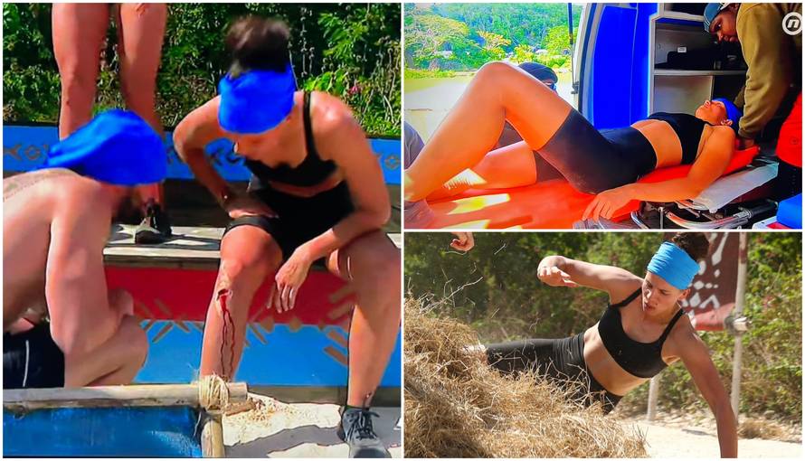 Mihaela iz 'Survivora' ozlijedila se na izazovu: Raskrvarila je koljeno, na nosilima je odnijeli