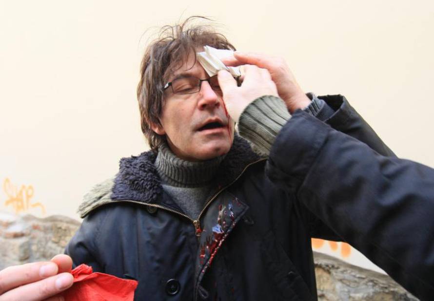 Željko Lukunić/Pixsell