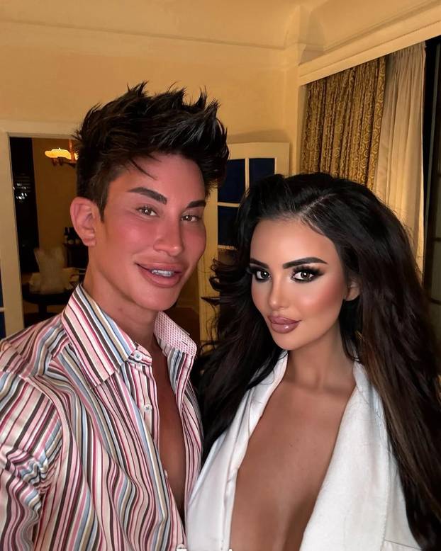 FOTO Brazilka Jennifer: Bila sam ovisna o estetskim zahvatima! Potrošila sam preko 800.000 $