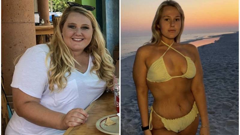 FOTO 'Dečki su me ostavljali zbog moje kilaže. Izgubila sam 80 kg i sad me žele natrag...'