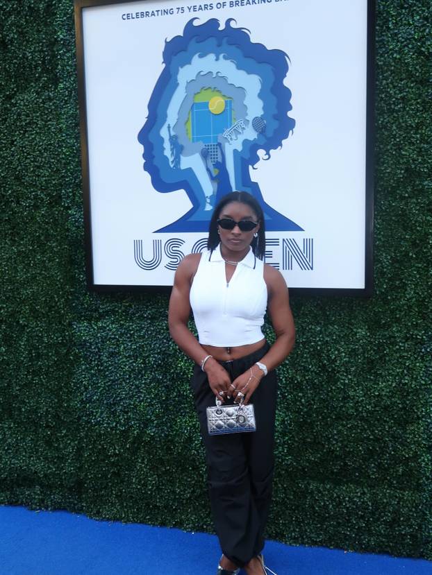 FOTO Olimpijska legenda: Imala sam tri plastične operacije. Za dvije ne biste mogli pogoditi...