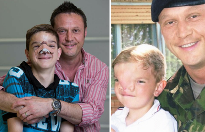 Pomogao mu britanski vojnik: Nakon 13 godina ima novo lice