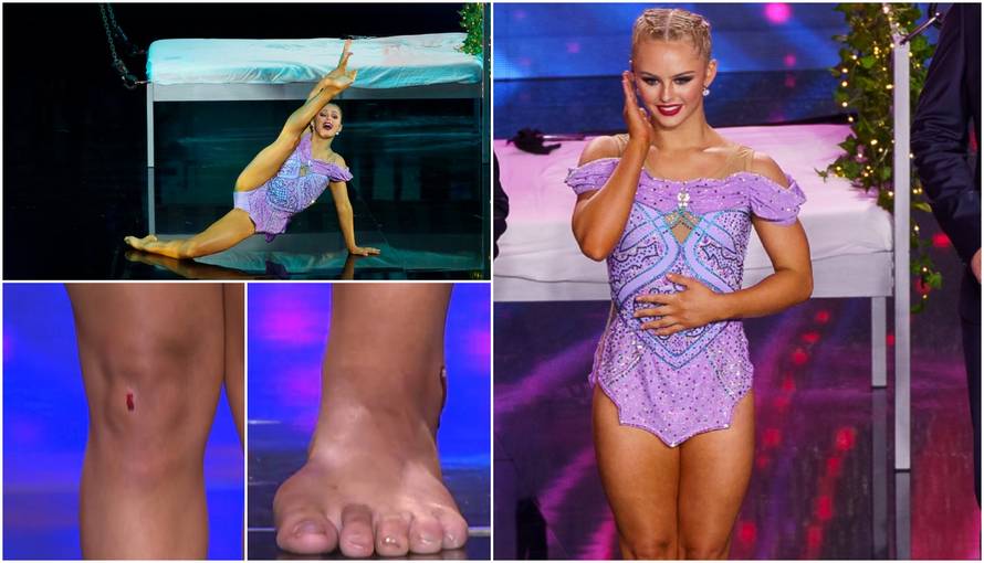 Siena raskrvarila nogu na nastupu, ali nije se obazirala