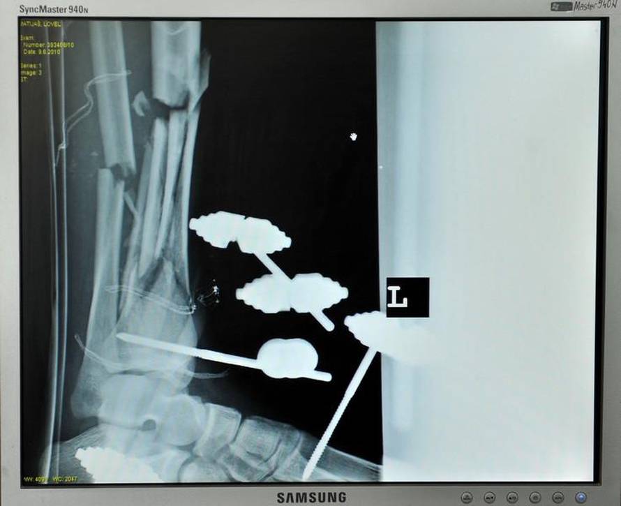 Marko Lukunić/PIXSELL