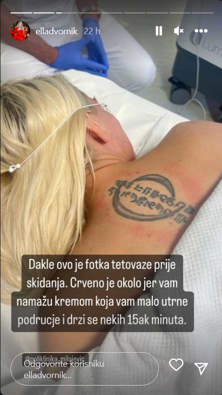 Ella Dvornik uklonila tetovažu na leđima: 'Ružna je kao smrt'