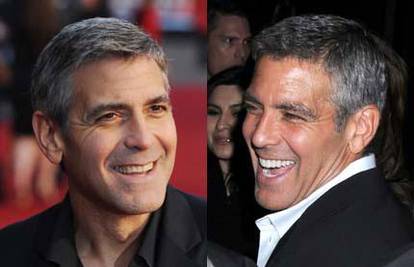 George Clooney si izbijelio osmijeh za 140.000 kuna